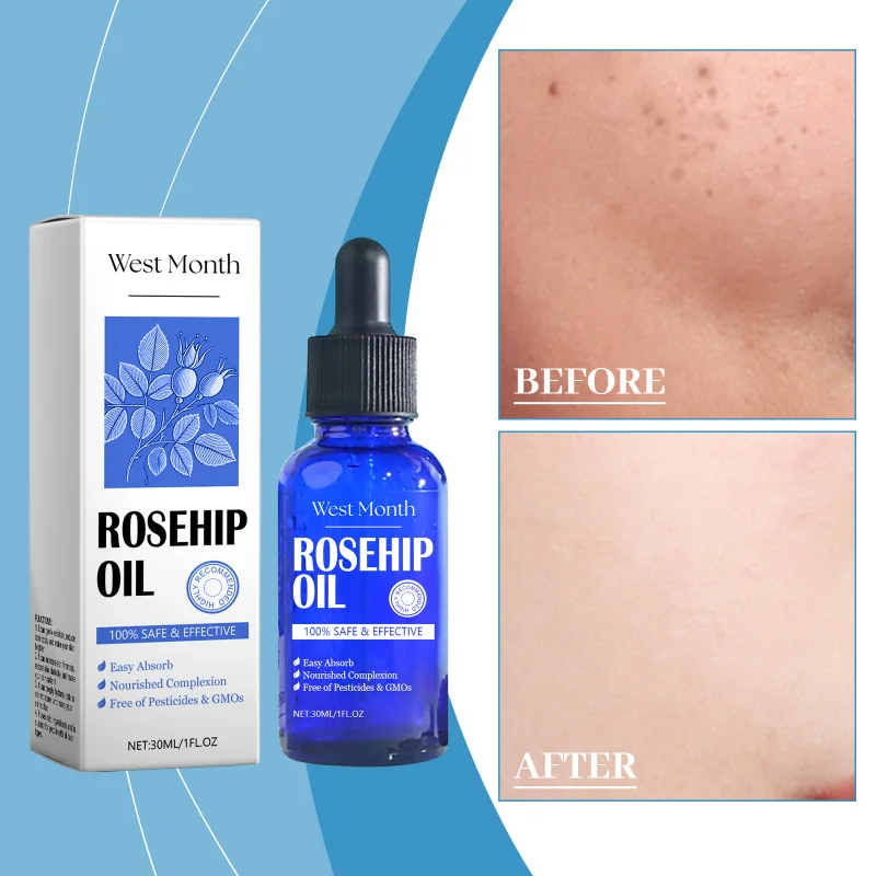 

Rosehip Skincare Oil, Facial Nourishment & Hydration, Moisturizes & Tightens Skin, Rejuvenating Essence For Daily Care