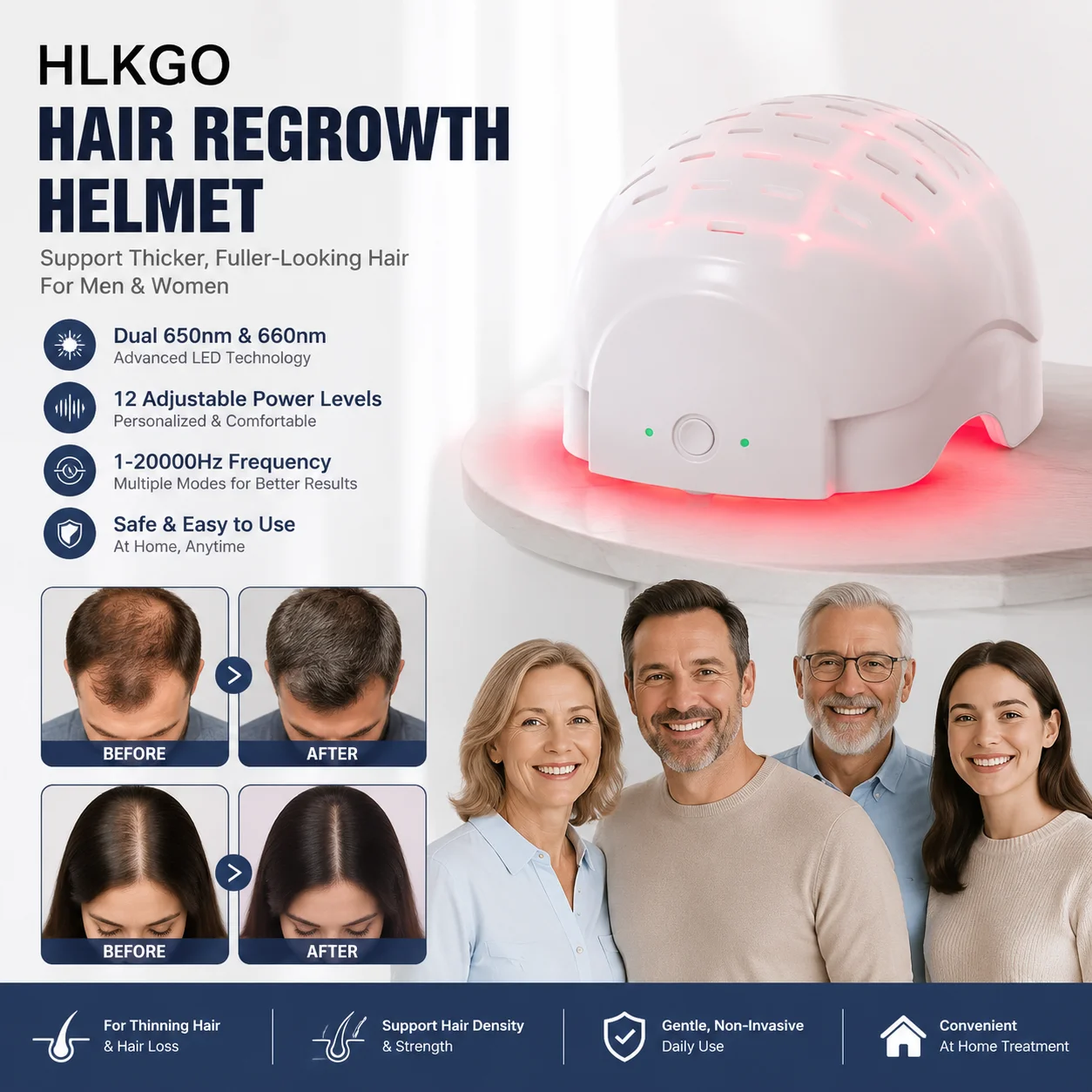 Wireless Scalp Laser Helmet – 660nm Deep Therapy + 650nm Follicle Activation, 10 Adjustable Intensities, CE Certification