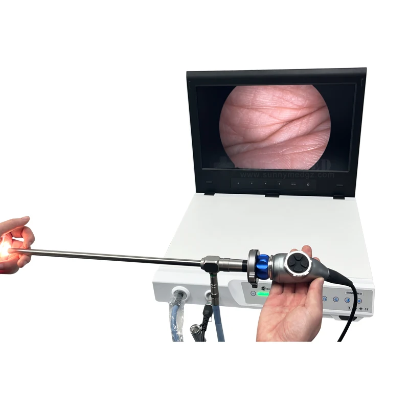 Sistema de câmera de endoscopia colonoscópio portátil SY-PS046B tudo-em-um dispositivo de imagem humana para cirurgia lapa-roscópica