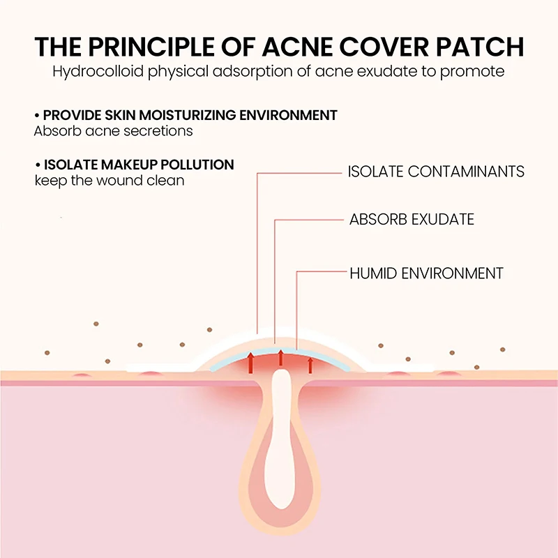 3 Sheets Colorful Love Acne Patches Breathable Acne Removal Absorb Secretions Anti Infection Originality Concealer Makeup Tool