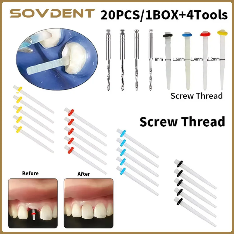 Complete Dental Quartz Fiber Post Kit 20 Posts 4 Drills Screw Straight Type for High Esthetic Root Canal Restoration