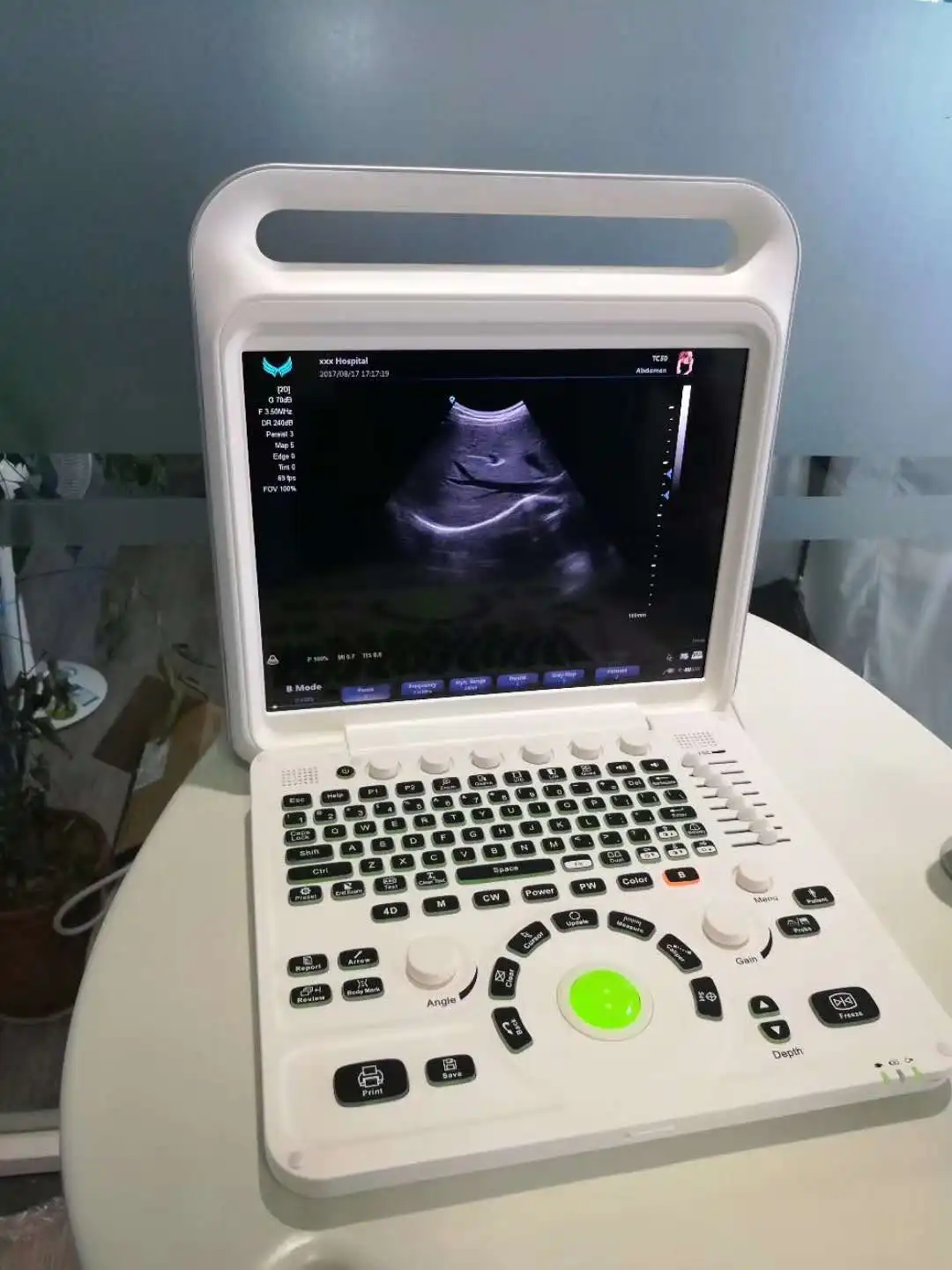 Medical Equipment 3D Image Laptop Portable Color Doppler Pregnancy Diagnostic Ultrasound