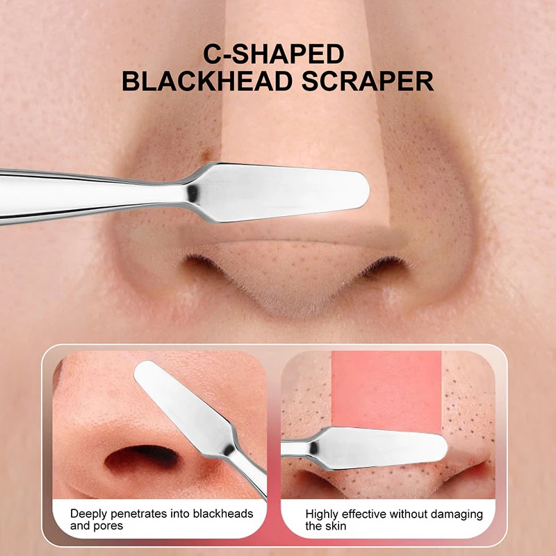 Extracteur de points noirs pour acné, élimination des boutons, outil de traitement, comédons blancs, acné, acné, défaut, visage antarctique