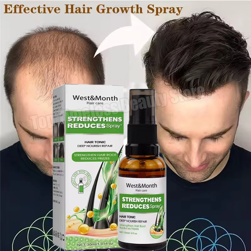 

Hair Growth Spray Prevent Hair Loss Anti Baldness Massage Scalp Treatment Nourish Strengthen Hair Thicken Fast Regrowth Liquid