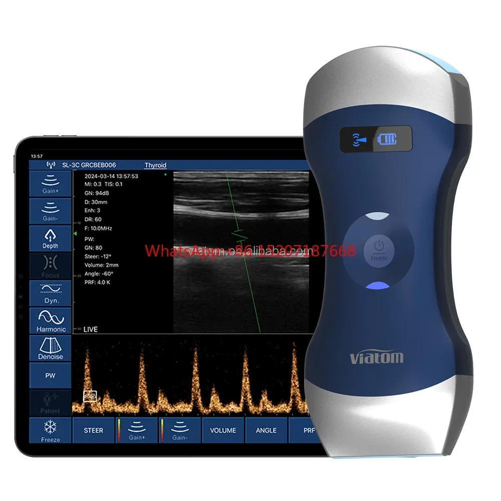 Scanner à ultrasons Doppler portable sans fil, 3 heures, batterie, temps de travail, 128 éléments, déterminer la sonde à ultrasons