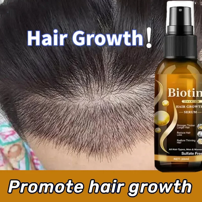 Biotin Hair Spray For Man Women 20ml Repair Damage Restore Oil Scalp Repair Serum Spray Thicken Hair Health Care New