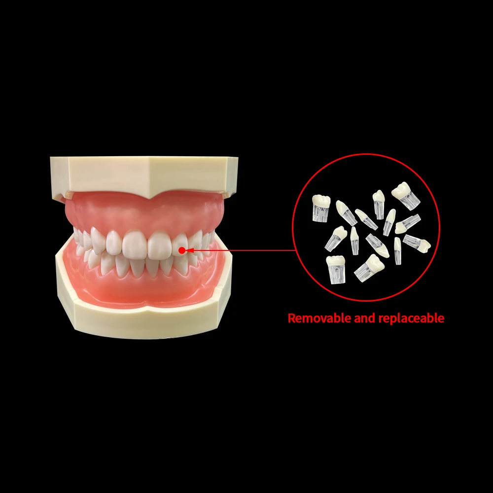 28pcs/set Dental Endodontic Model Full Mouth Tooth Pulp Cavity Study Model Root Canal Block Training Practice Demonstration Tool