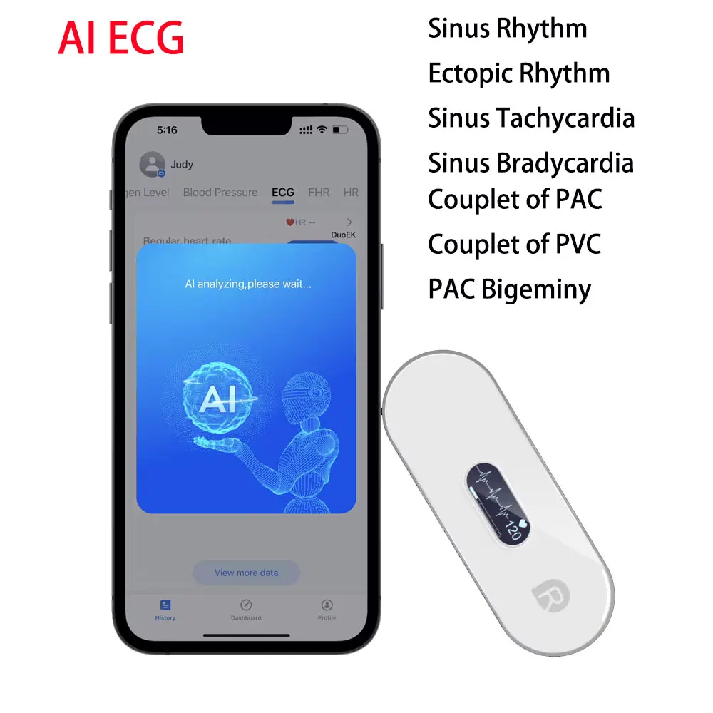 Monitor ECG Bluetooth con ECG OLED, análisis AI, ritmo, Holter, Monitor de salud cardíaca, pantalla que muestra EKG en tiempo Real