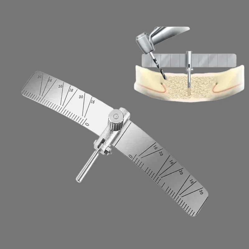 

Поправляющая для зубных имплантатов, локатор, хирургическая линейка, регулируемый измерительный инструмент для посадки в стоматологии с угловым манометром