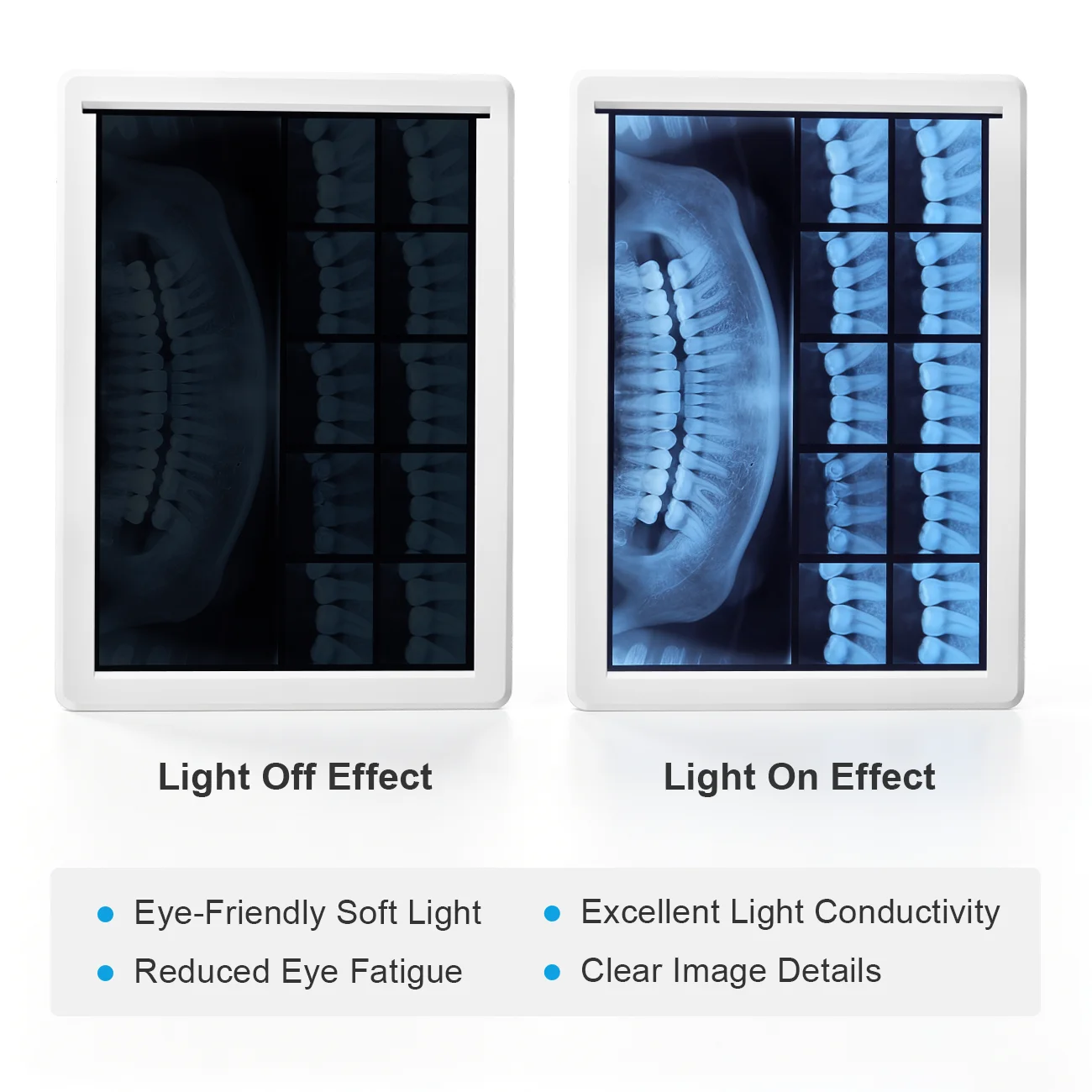 NEW Dental X-Ray Film Illuminator Light Box Xray Viewer Light Panel Screen Dentist Oral hygiene panorama viewbox