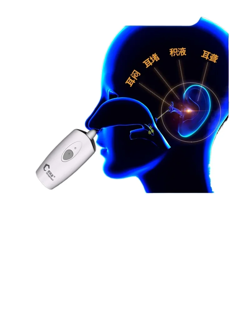 

Bangershi, Eustachian tube blower, middle ear negative pressure constant pressure effusion, children's eardrum depression and