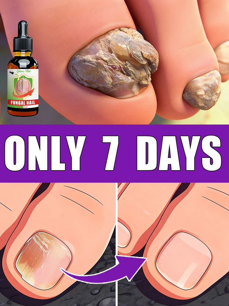 

Reduce your worries and stop fretting about your nails.