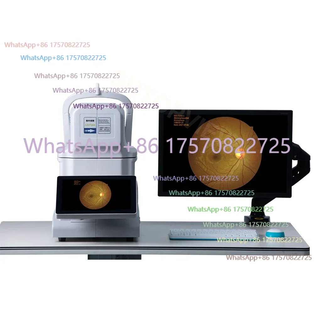 One-click Operation Automatic Fundus camera- Retinal camera- With Puzzle function