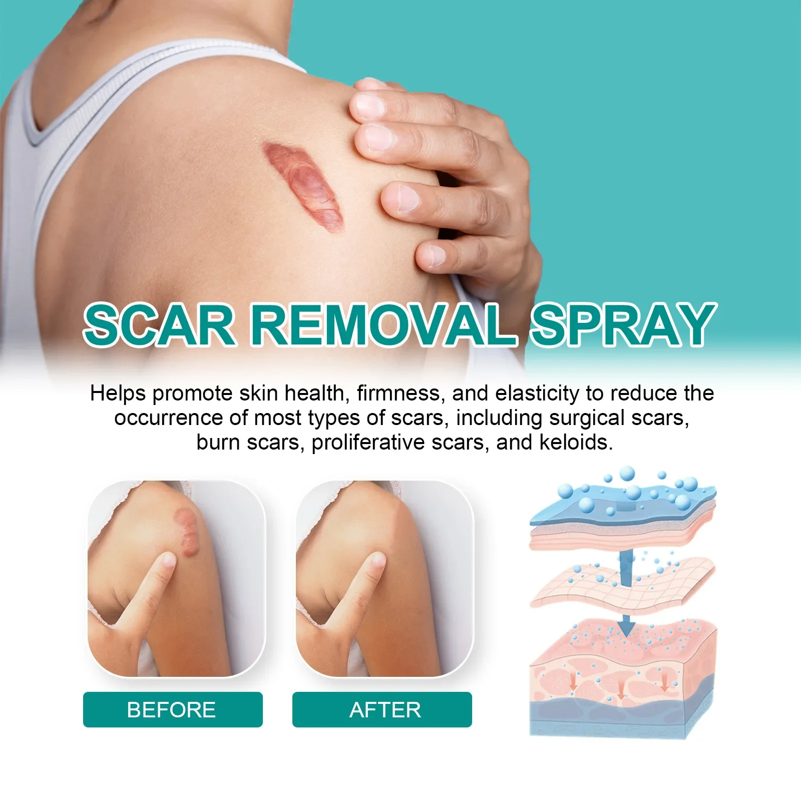 Scar Care Spray Fade Scars Pregnancy Smooth Skin Repair Spray