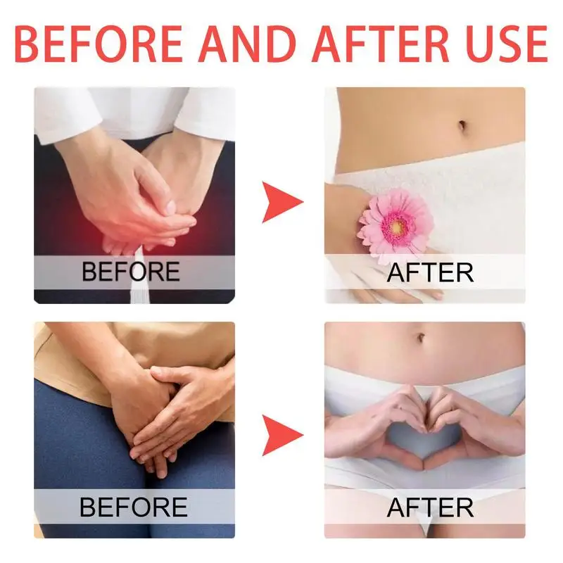 Krim Perawatan Gatal Vagina Wanita Pengecil Keseimbangan Vagina Detoks Bagian Pribadi Mengurangi Gatal Peremajaan Bau Perawatan Anti Infeksi