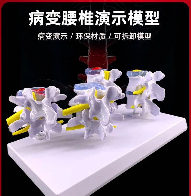 Trauma Teaching Human Anatomy Skeleton Spine 4-Stage Lumbar Model with Brain Skull