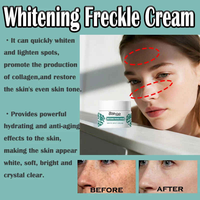 EELHOE نيكوتيناميد النمش كريم مزيل الكلف كريم إزالة التصبغ ترطيب مصل إزالة البقع الداكنة