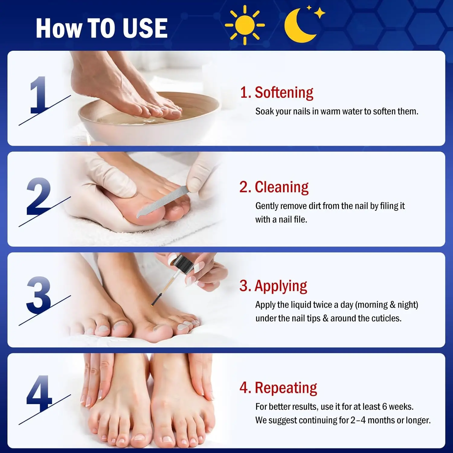 سائل تعقيم فطريات الأظافر 30 مل - العناية بالأظافر فطار الأظافر يساعد على تحسين متشقق متغير اللون لأظافر القدم والأظافر