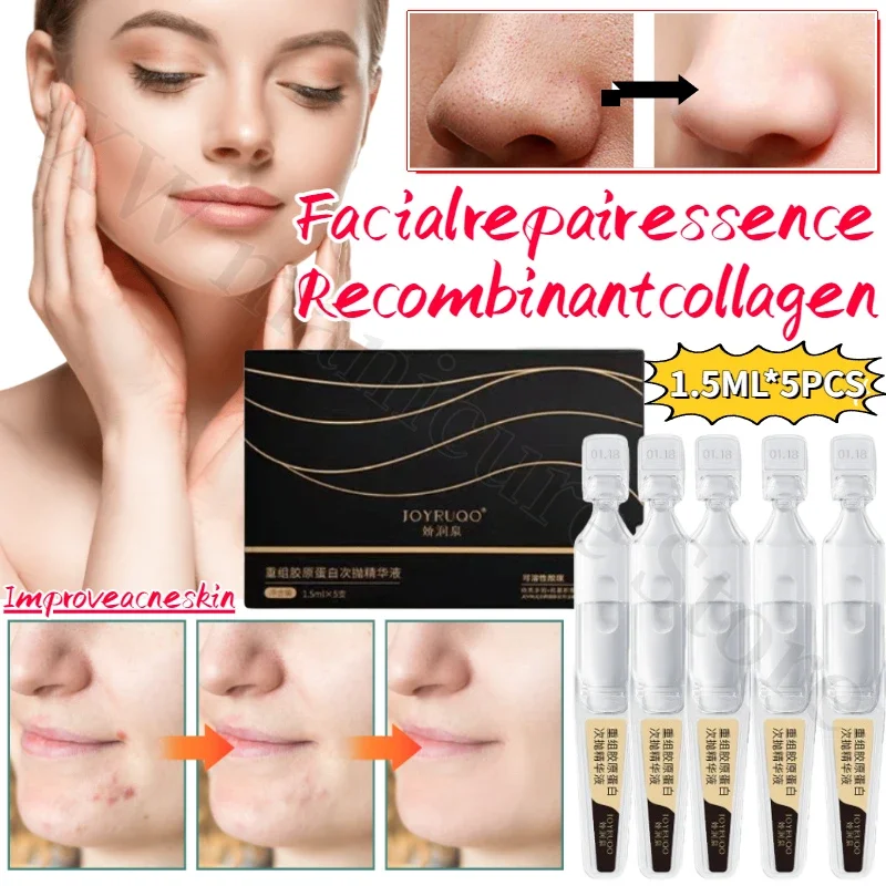 

JOYRUQO Essence Repairs Damaged Pores, Blemishes, Hydrating and Firming Skin Essence Facial Skin Care Restructures Collagen