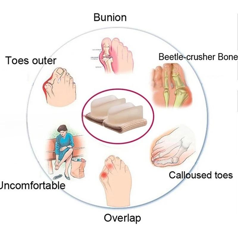 Cuidado de los pies Hallux Valgus pulgar suministros ortopédicos tirantes correctos diarios punta de silicona hueso grande herramienta de cuidado de los pies cuidado de los pies