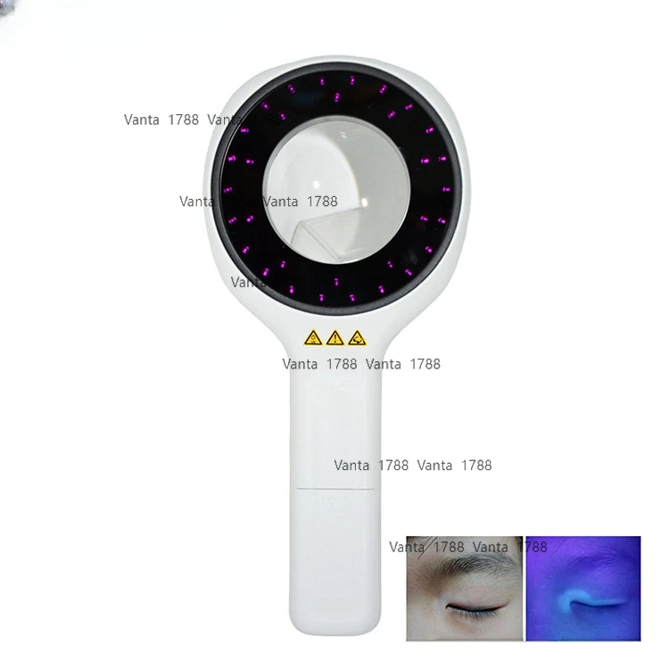 Wood Lamp Testing T… - image