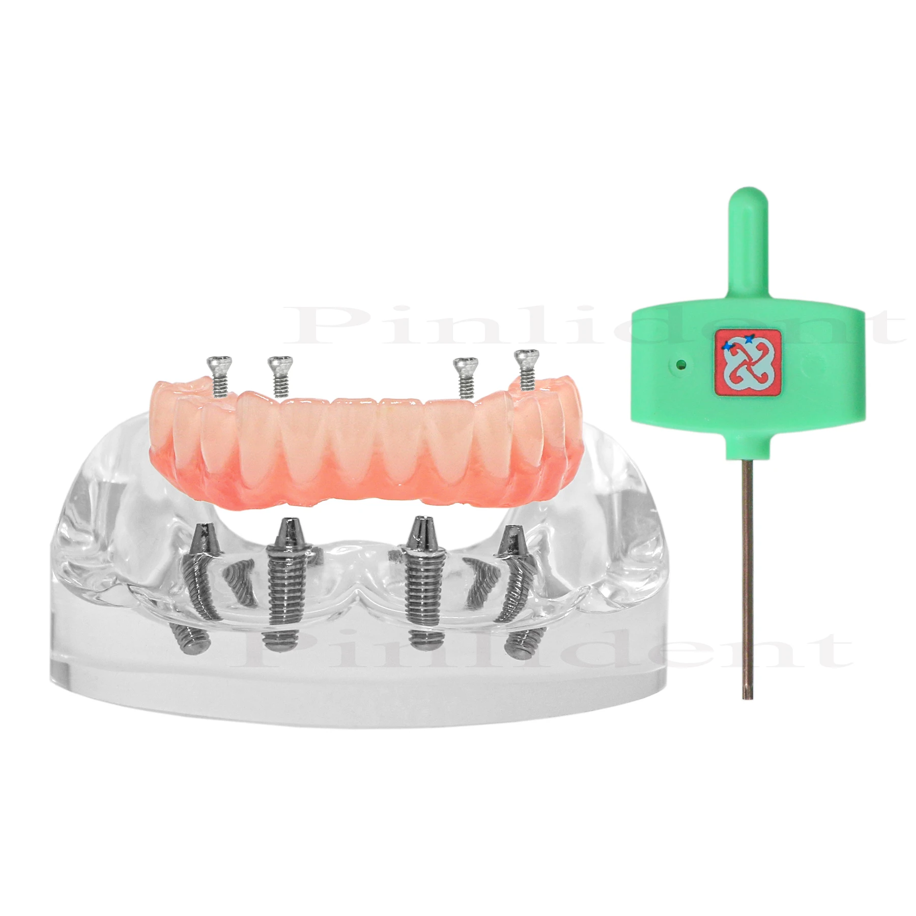 Mandibular Dental Implant Teeth Model M6027 Transparent Lower Jaw Type All on 4 Overdenture Modle With 4 Removable Screws