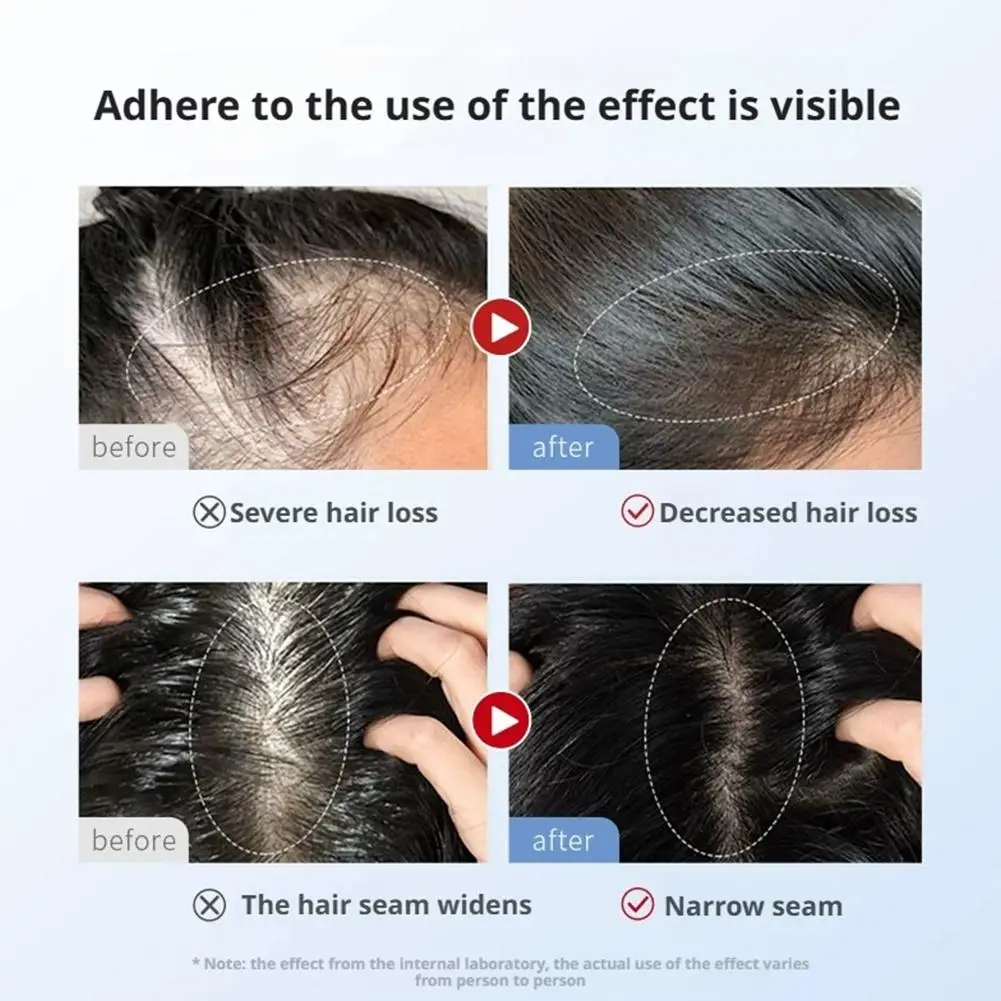 

Hair Dense Roll-On Essence White Hair To Black Hair Strengthen Hair Quality Hair Scalp Enhance Root Serum Essence Hair Grow T7C6