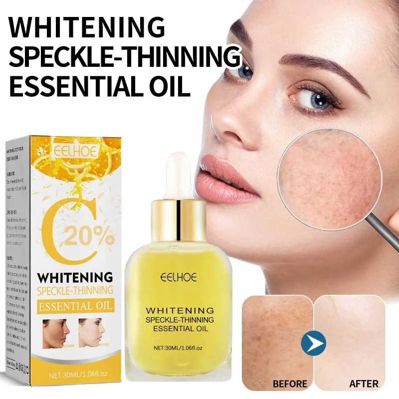 Whitening Spikkel-uitdunnen Essentiële Olie Donkere Vlek Remover Hydraterende Reparatie Anti-aging Essentie Gezichtsverzorging Product 30 ml