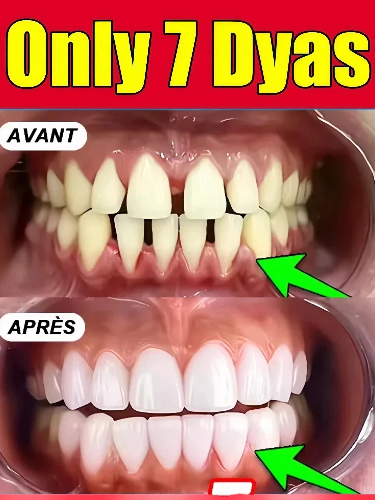 2025Hot selling tooth drops, repair damaged gums, relieve gum pain, strengthen gums, restore healthy gums yyds