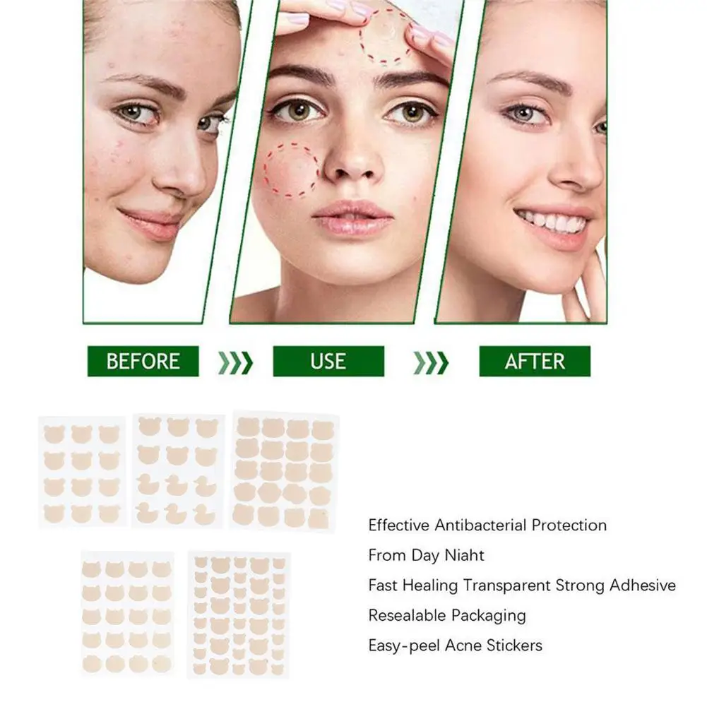Skin Color Hydrocolloid Acne Patch Mask Acne Patch Care Acne J8Y0