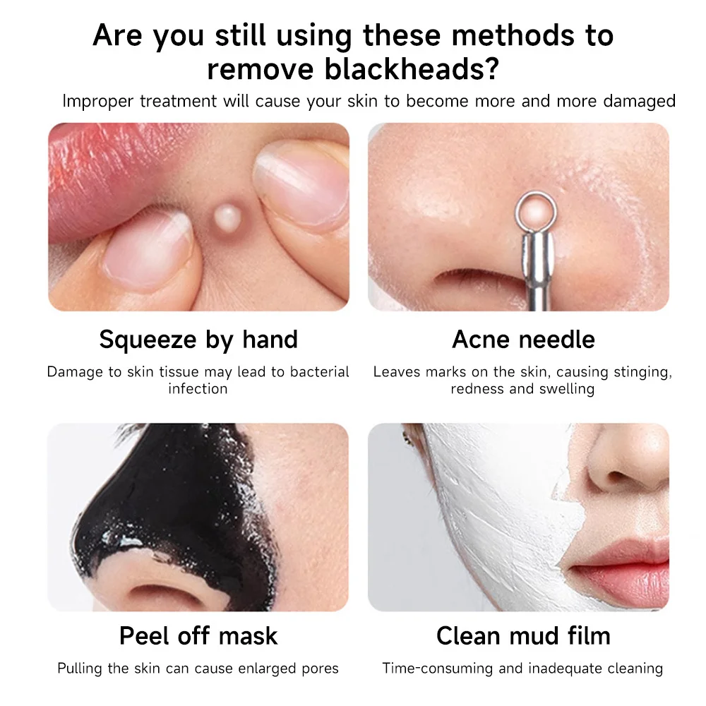 Gereedschap voor het verwijderen van mee-eters voor het verwijderen van puistjes en vlekken Zachte poriënreiniging Exfoliërende acneverwijdering Diep schoon