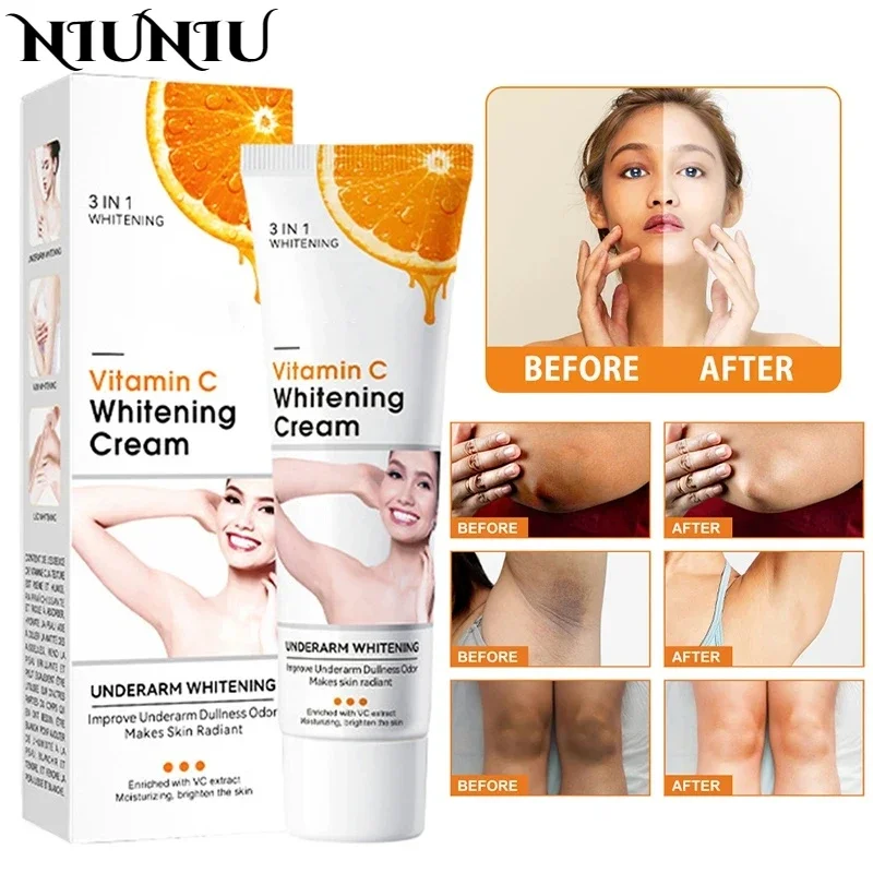 Fade Melanin Vitamin C Brightening Cream for Elbows Knees Armpits Intimate Areas Bleaching Lotion Brighten Knuckles Body Care