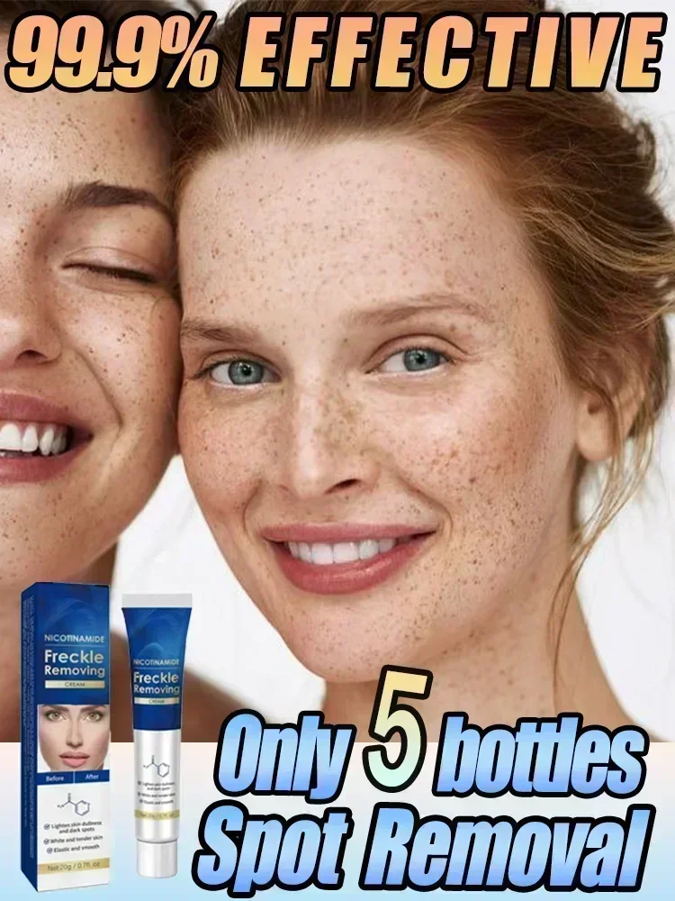 

Effictive Dark Spot Remover cream for Face Removing Freckle Melasma Chloasma Senile Plaques Sunburn Cyasma Chorioplaque Freckle