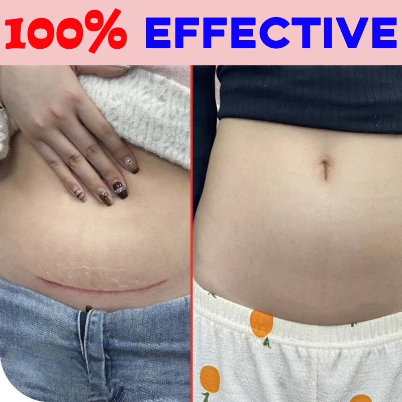 100% beautiful and flawless skin