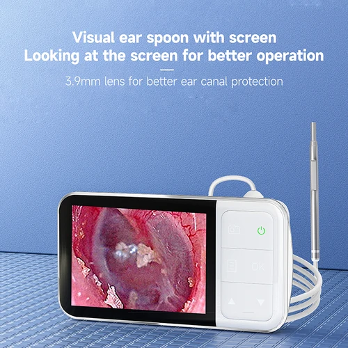 Imagen 2 del producto Otoscopio Digital para limpieza de oídos, endoscopio con lente de 3,9 MM, HD1080P, pantalla de 4,5 pulgadas, Monitor de cámara, Otoscopio