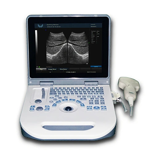 

Black White Ultrasound Machine BW Cheap XF ultrasound Laptop Ultrasound Scanner