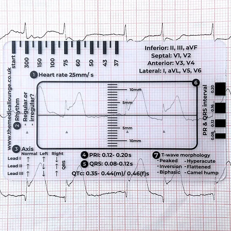 EKG/EKG Rhythmus Taschenkarte Taschenkarte für EKG Selbstmesslineal EI Einschließende Leitungen Präzisionsmessung Haushaltswerkzeug – Detail 6