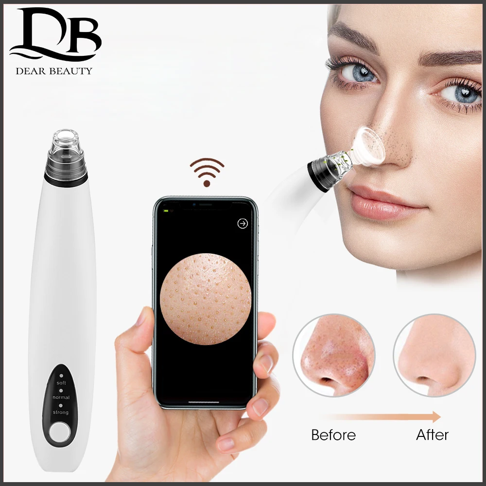 

Three Levels Visual Electric Blackhead Absorbing Device Export Cleaner Pore Cleansing Remove Excess Cutin Keep Skin Delicate