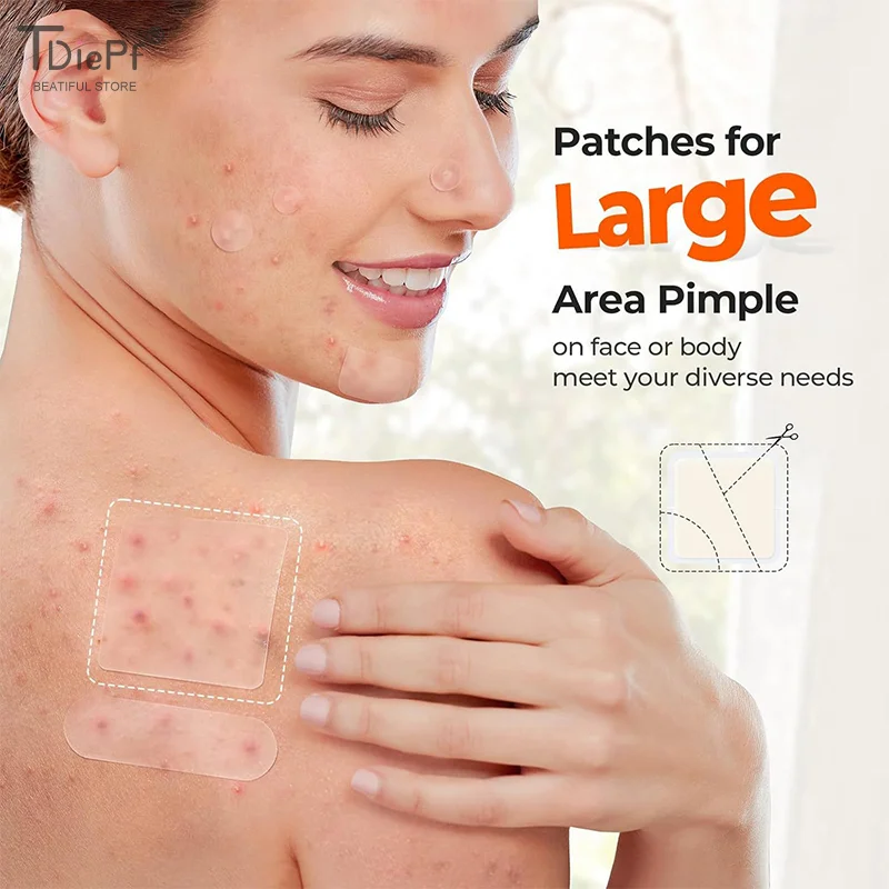 1Sheet Hydrocolloid Face Acne Patch Fade Invisible Body Nose Stickers Acne Suction Pus Acne Patch Removal Stickers Skin Care