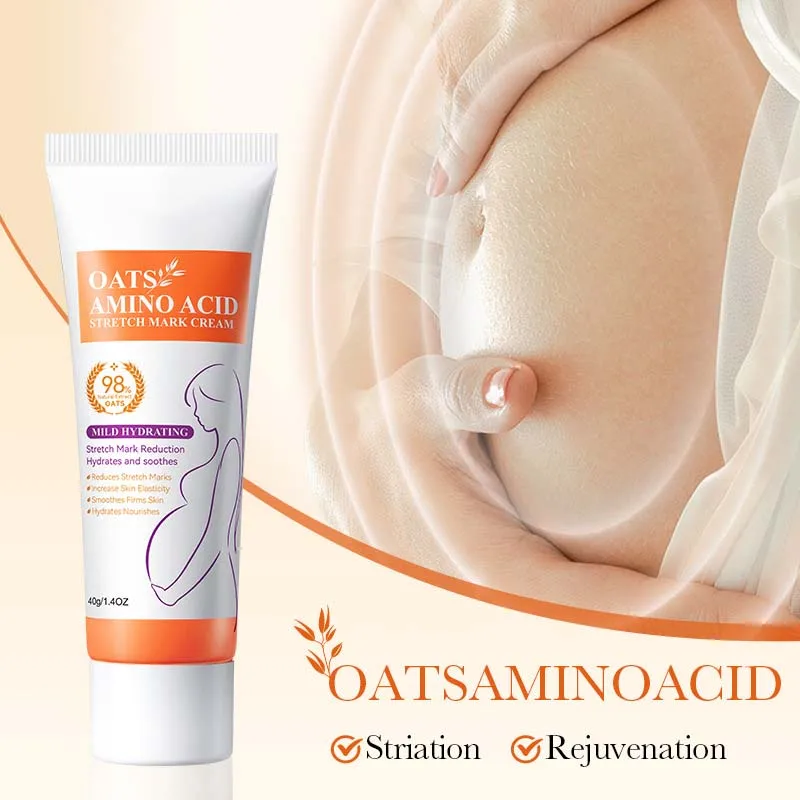 Rremove Pregnancy Stretch Marks Cream Improves Elasticity Fade Growth Lines Smoothing Nourishing Moisturizing Firming Skin Care