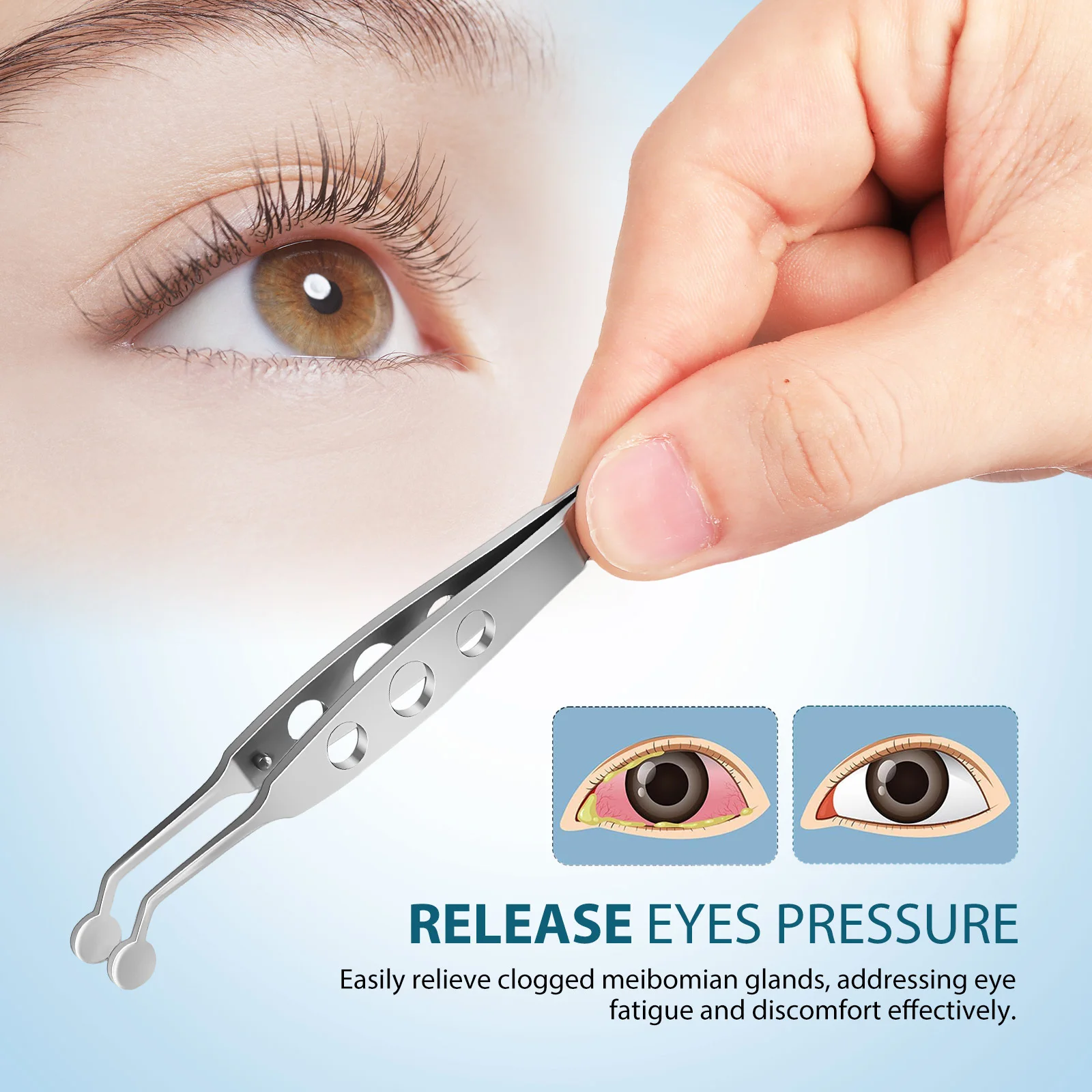แหนบสแตนเลสสำหรับนวดถุงน้ำตา Meibomian ออกแบบอย่างแม่นยำ ปลายมน สำหรับช่างต่อขนตา ใช้กำจัดติ่งเนื้อในถุงน้ำตา