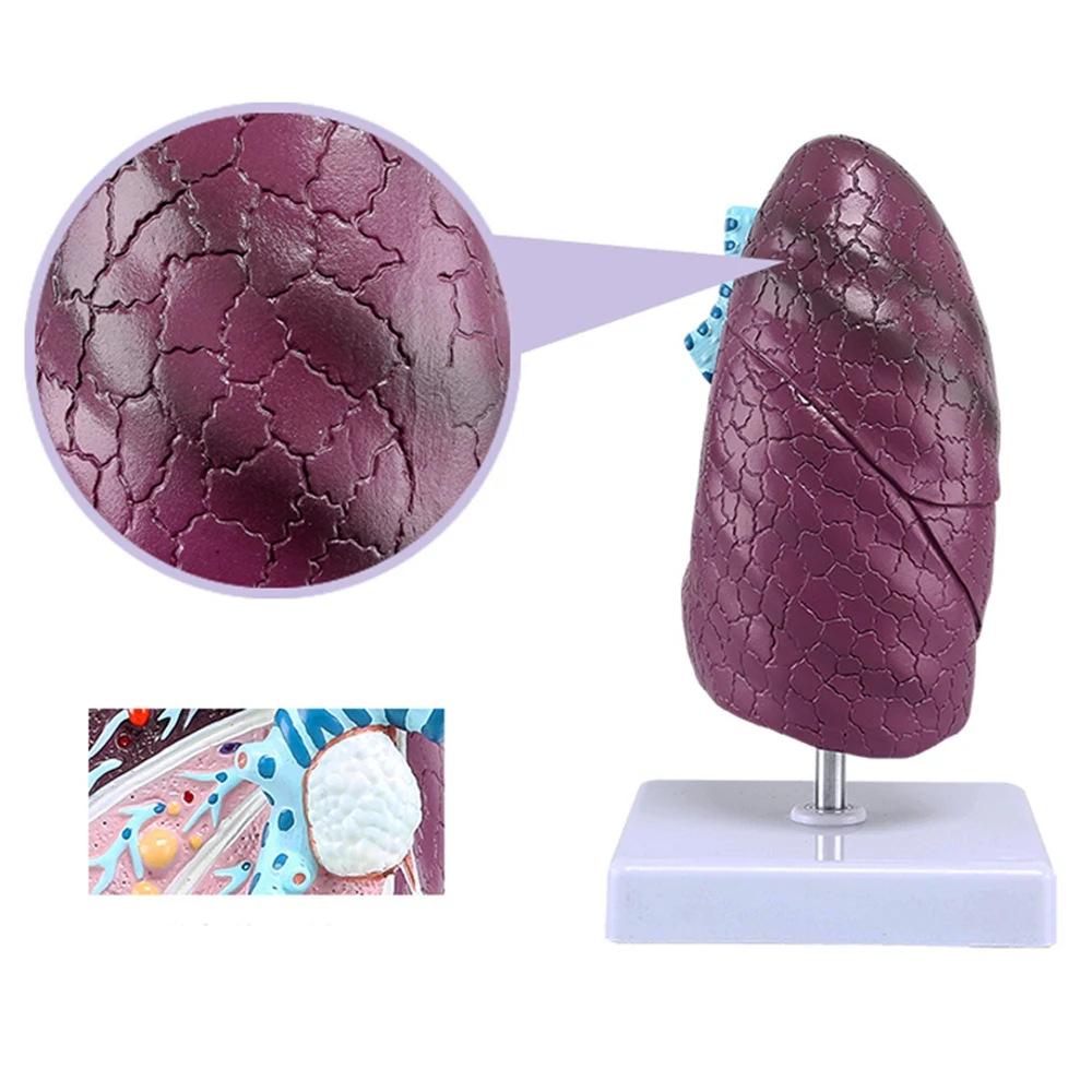 Human Lung Model Pathological Lung Anatomy Model Human Organ Model for Doctors Office Educational Tool
