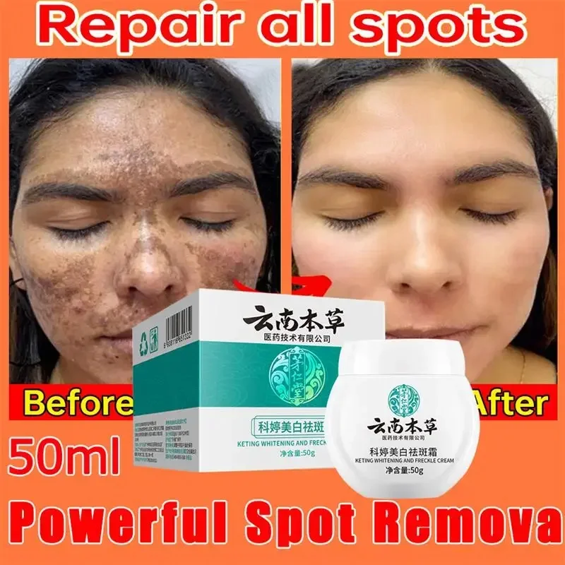 20g/50g Dark Spot Corrector Skin Whitening Fade Cream Lighten Blemish Removal Serum Reduces Freckles
