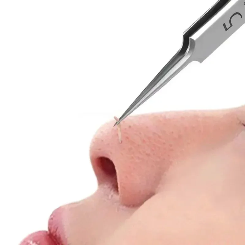 German Ultra-Fine No. 5 Cell Blackhead Tweezers High Precision Acne Pimple Remover Clip Deep Pore Cleaning Beauty Salon Tools