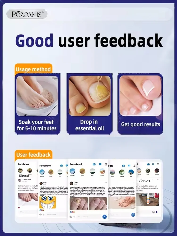 The most powerful black technology in 2025,ᵉᶠᶠᵉᶜᵗⁱᵛᵉ ⁿᵃⁱˡ ᶠᵘⁿᵍᵘˢ ᵗʳᵉᵃᵗᵐᵉⁿᵗ⸴ ʳᵉˢᵗᵒʳᵉ ⁿᵃⁱˡ ʰᵉᵃˡᵗʰ ⁱⁿ ⁷ ᵈᵃʸˢ