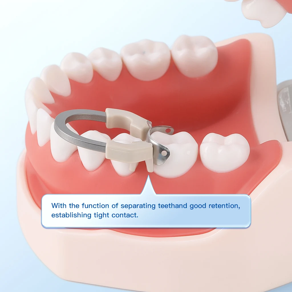 3-teiliges AZDENT Dental-Sektionsmatrizesystem, Matrizen, Clip-Ring, konturierte Matrizenbänder, Titan-Klemmring, universell schmal, tief – Detail 13