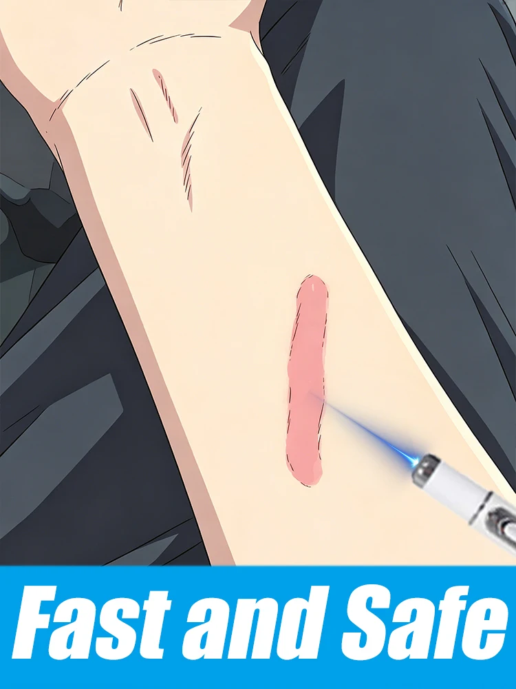 

New 2nd generation laser pens to fade your scars and maintain smooth skin