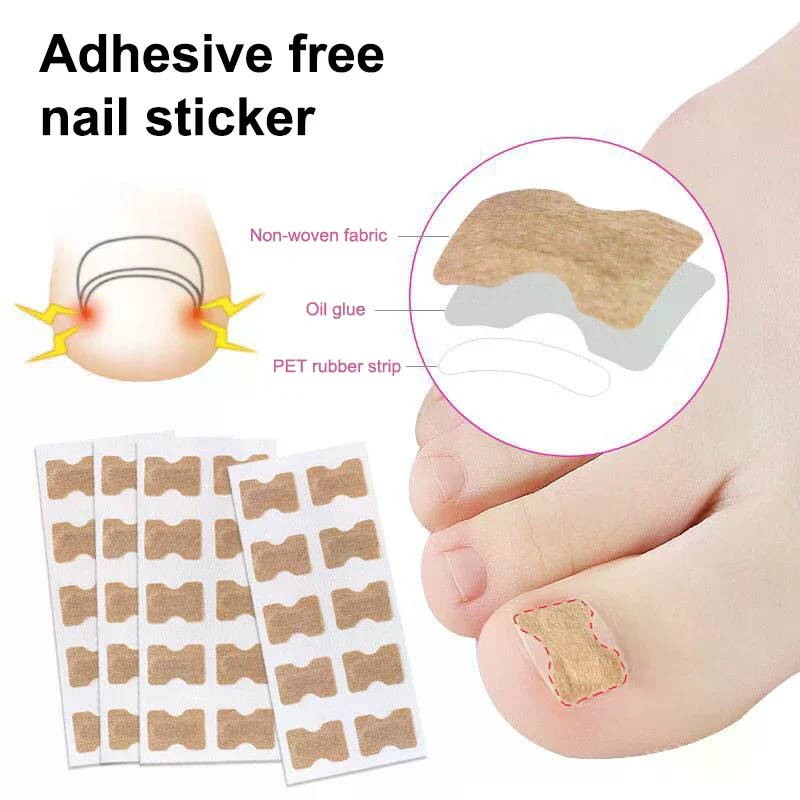 المهنية نام أظافر القدم مصحح ملصقات مجموعة تو العناية بالأظافر أدوات باديكير الرعاية الصحية يحمي علاج الداحس #2
