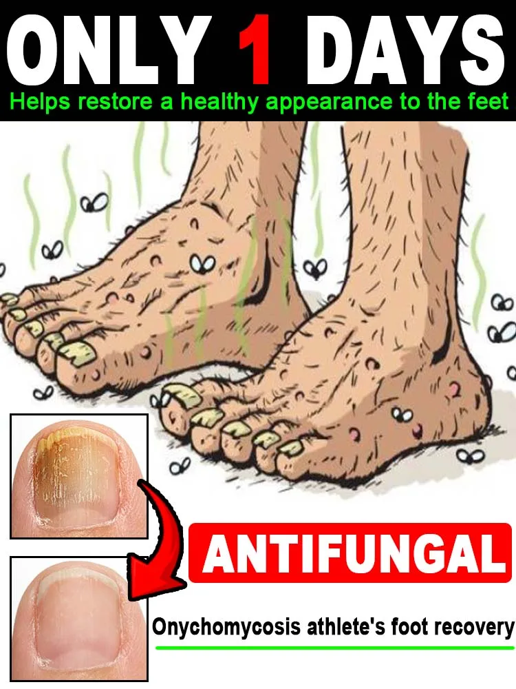 

Nᴇᴡ Fᴏᴏᴛ ᴄʟᴇᴀɴɪɴɢ Sᴘʀᴀʏ Rᴇsᴛᴏʀᴇs ғᴏᴏᴛ Hᴇᴀʟᴛʜ,Relax every day