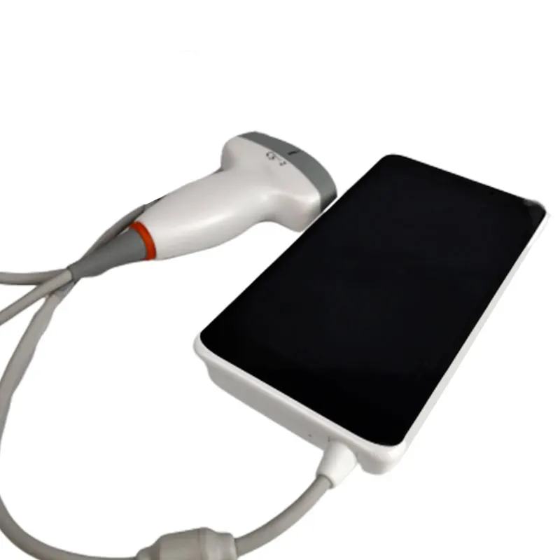 

Smart ultrasound, Android portable ultrasound scanner/Handheld color Ultrasound